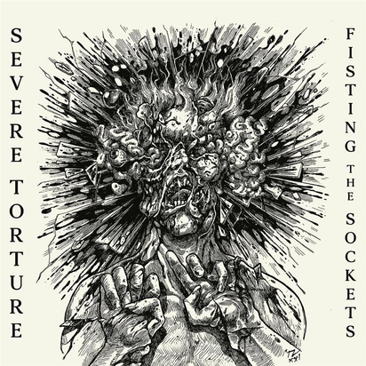 Severe Torture "Fisting The Sockets"