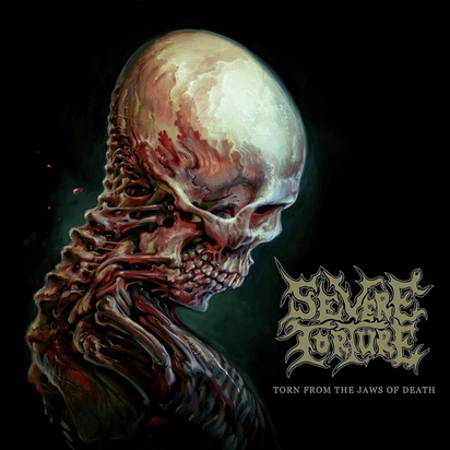 Severe Torture "Torn From The Jaws Of Death"